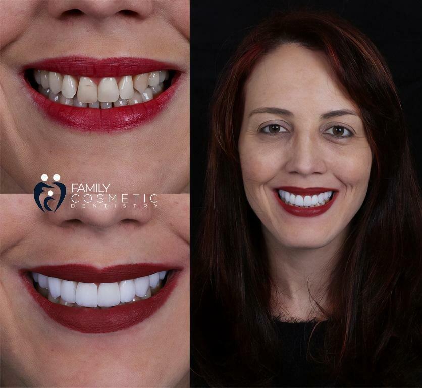 Family Cosmetic Dentistry