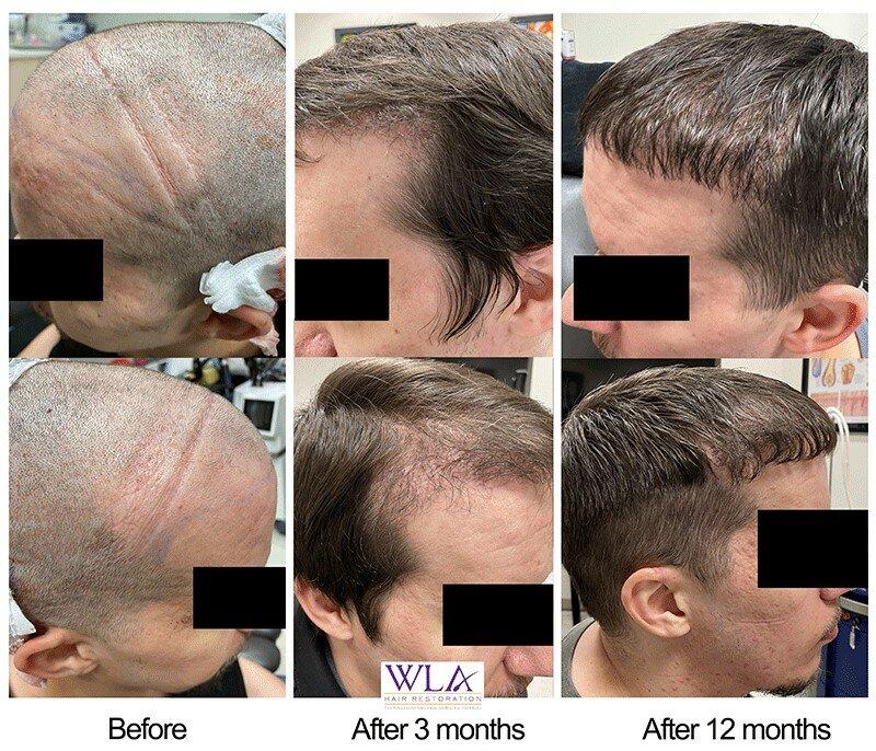 West La Hair Restoration