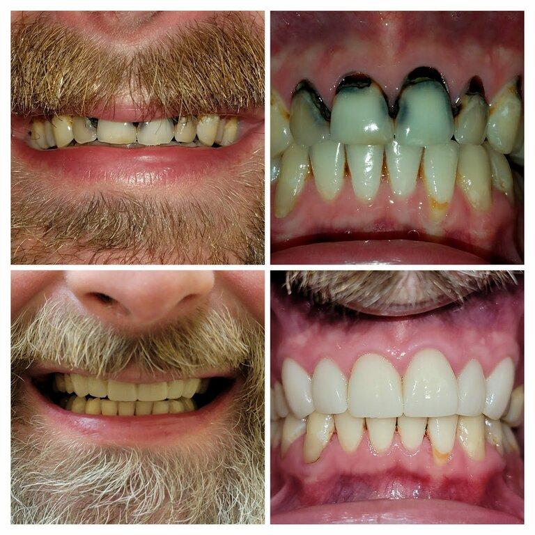 Love Your New Smile: Dr Peter Diacoloukas