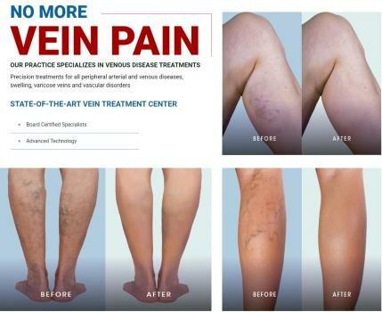 Vein Care Center