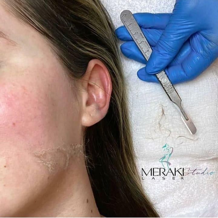 Meraki Skin & Laser Studio