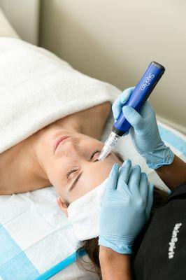 Treat texture concerns and brighten the skin with a microneeding treatment.