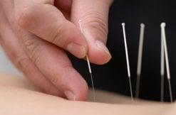 Acupuncture helps with fatigue, allergies, migraines, high blood pressure, high cholesterol, women's health issues & infertility