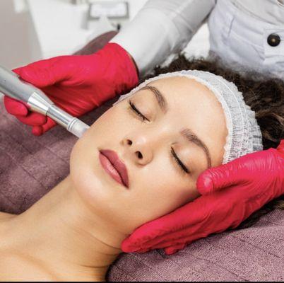 Microneedling