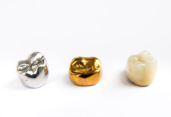 We purchase all dental gold crowns, fillings and bridges.