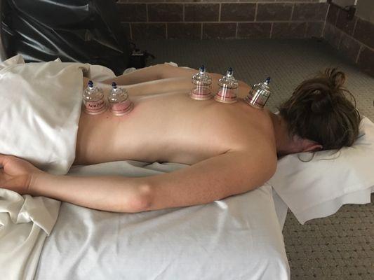 Cupping therapy can be added to most sessions, as it is here on a US Biathlon team member.