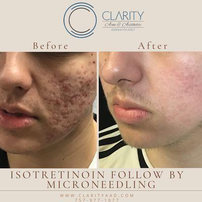 Clarity Acne & Aesthetic Dermatology