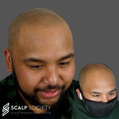 Scalp Society