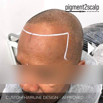 Bringing back hairlines. Hairline design must be approved before any tattoo work begins to ensure clients' total satisfaction.