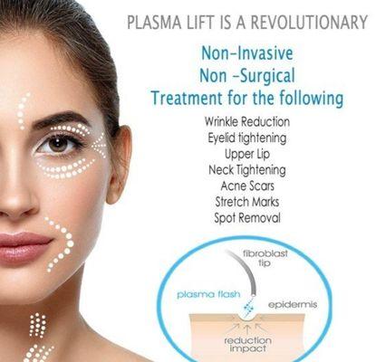 Plasma Lift