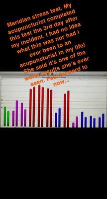 Meridian stree test from my 1st visit. I was a mess! Couldn't walk, headaches, dizzy, couldn't write with my right hand.