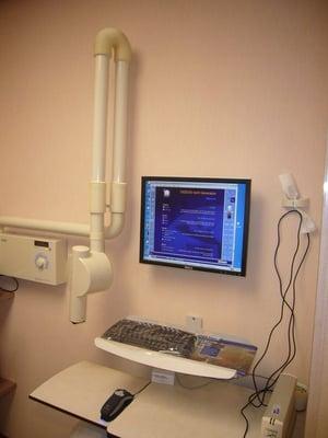 Digital X-Ray Machine