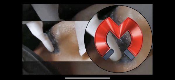 Magnetic  Tattoo Removal