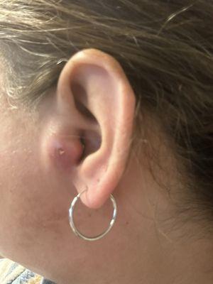 Tragus piercing