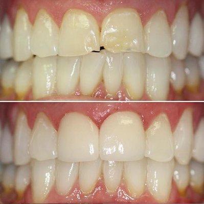 Cosmetic Dentistry