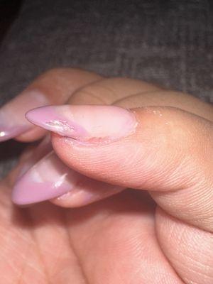 Left pinky: smudged/scraped nail polish