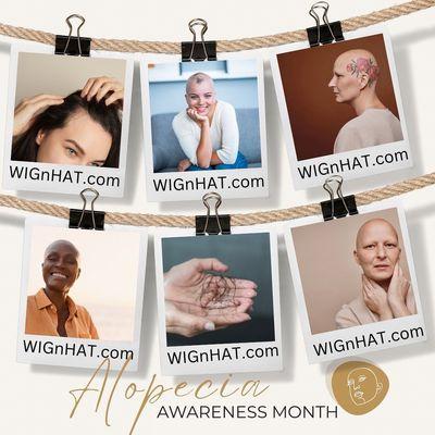 Alopecia Awareness