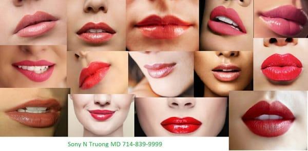 Lip Injections with dermal fillers Restylane or Juvedermx XC. Orange County Ca.  Sony Truong MD  Www.struongcosmetic.com