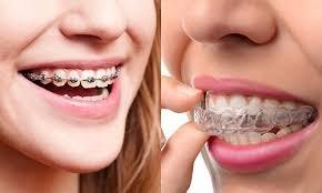 We offer traditional as well as Invisalign orthodontics!