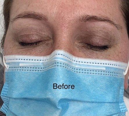 I had previous microblading done and very sparse eyebrows. Her technique is much better than previous artists I've used.