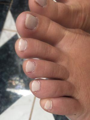 Ugliest Pedicure I ever got