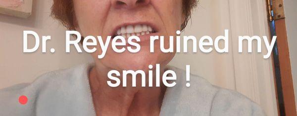 Worse place ever! FAKE SMILE   Dr. Reyes Refused to replace only at additional cost Every procedure- 4, had to be redone for repairs.