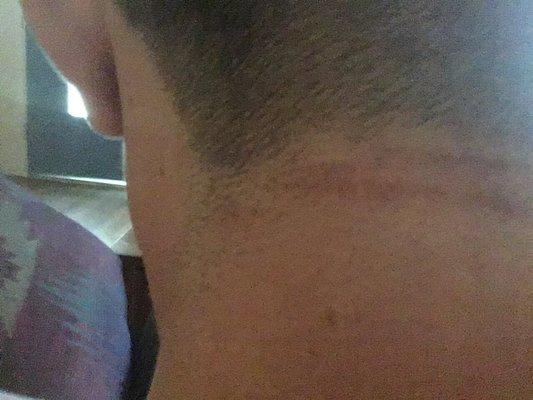 This is the back of my neck where Angel cut me.