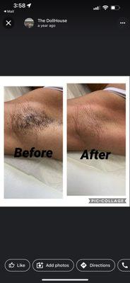 Before & After underarm wax