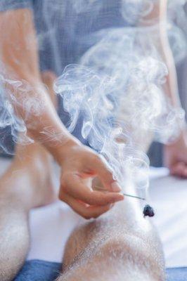 Moxibustion is a great technique used to warm acupuncture points to promote healing.