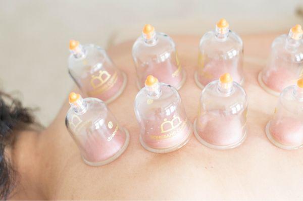 Cupping - stationary or moving cupping - you pick