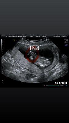 Baby hand