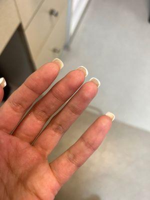 Problem with every single nails!!!