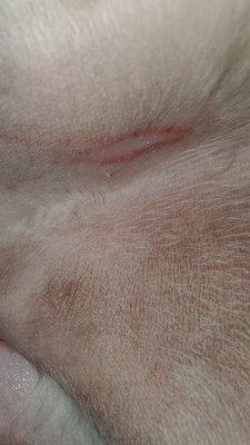 This is a picture of a cut my dog recieved under her right rear leg