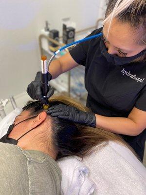 HydraFacial Keravive Scalp Treatment