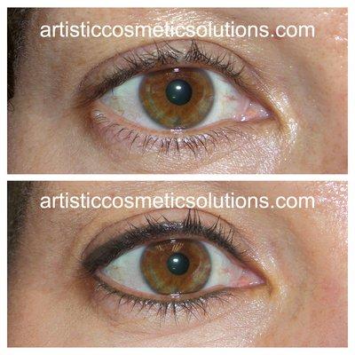 Before and After Permanent Eyeliner, upper and lower eyelid.