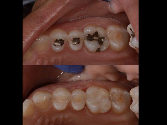 Same Day Dentistry