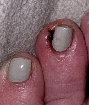 Today what my toe looks like