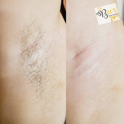 Underarm wax! Before was 4 weeks of growth!