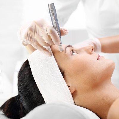 MDPen Microneedling is used to reduce lines, wrinkles, sun damaged skin and the effects of aging.