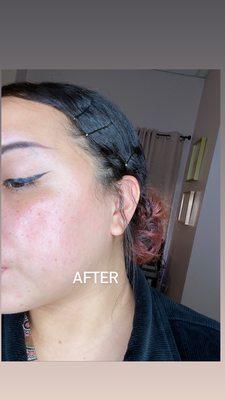 8 minute results after using the Phyto Corrective Essence Mist by SkinCeuticals, in stock at our spa