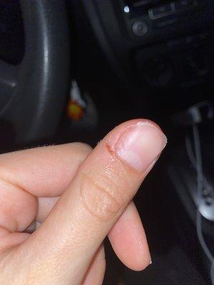 Just one example of a cut I got from the woman trying to scrape off my acrylics, it was worse than it looks like in the picture.