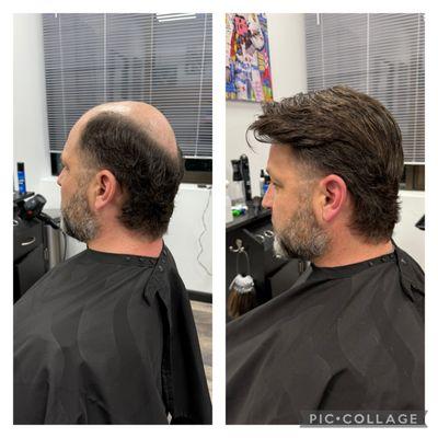 Before and after of non-surgical hair replacement. This hair system is a lifechanging solution to hair loss. You don't have to be bald!