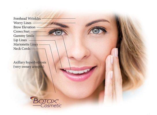 $8.99 Botox Cosmetic Orlando