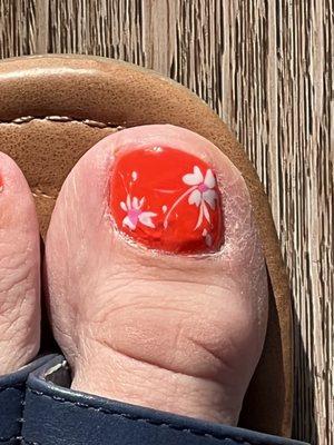 The other toe.....is a clumpy, ugly mess.