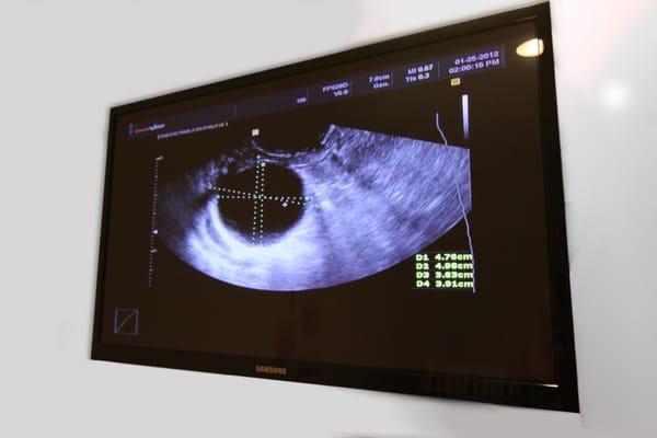 43" inches screens to get a better view of your baby !