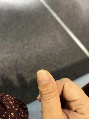 Destroyed my thumb nail