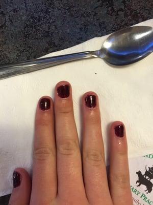 Awful nails.