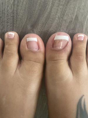 Right Toe Horrible