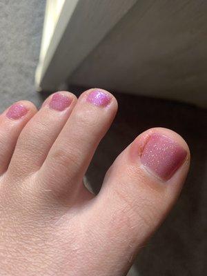 Day after pedicure