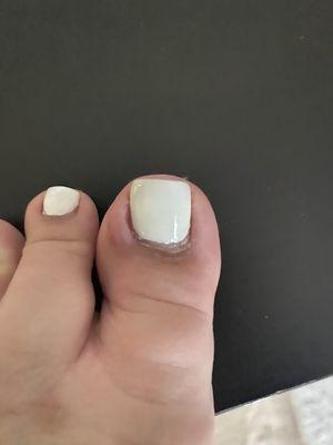 Rush pedicure, infection